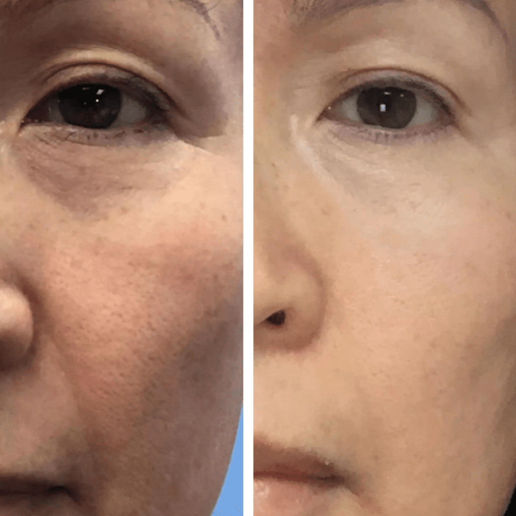 EMANI VEGAN COSMETICS - Sleep & Renew Super Serum - Cell Turnover and Refine Pores