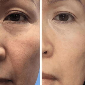 EMANI VEGAN COSMETICS - Sleep & Renew Super Serum - Cell Turnover and Refine Pores